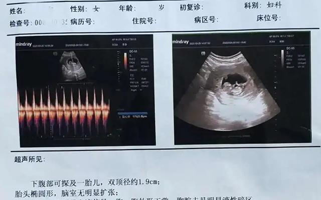 包生男孩是真的吗(包生男孩是真的吗?一起来探讨这个神秘现象)
